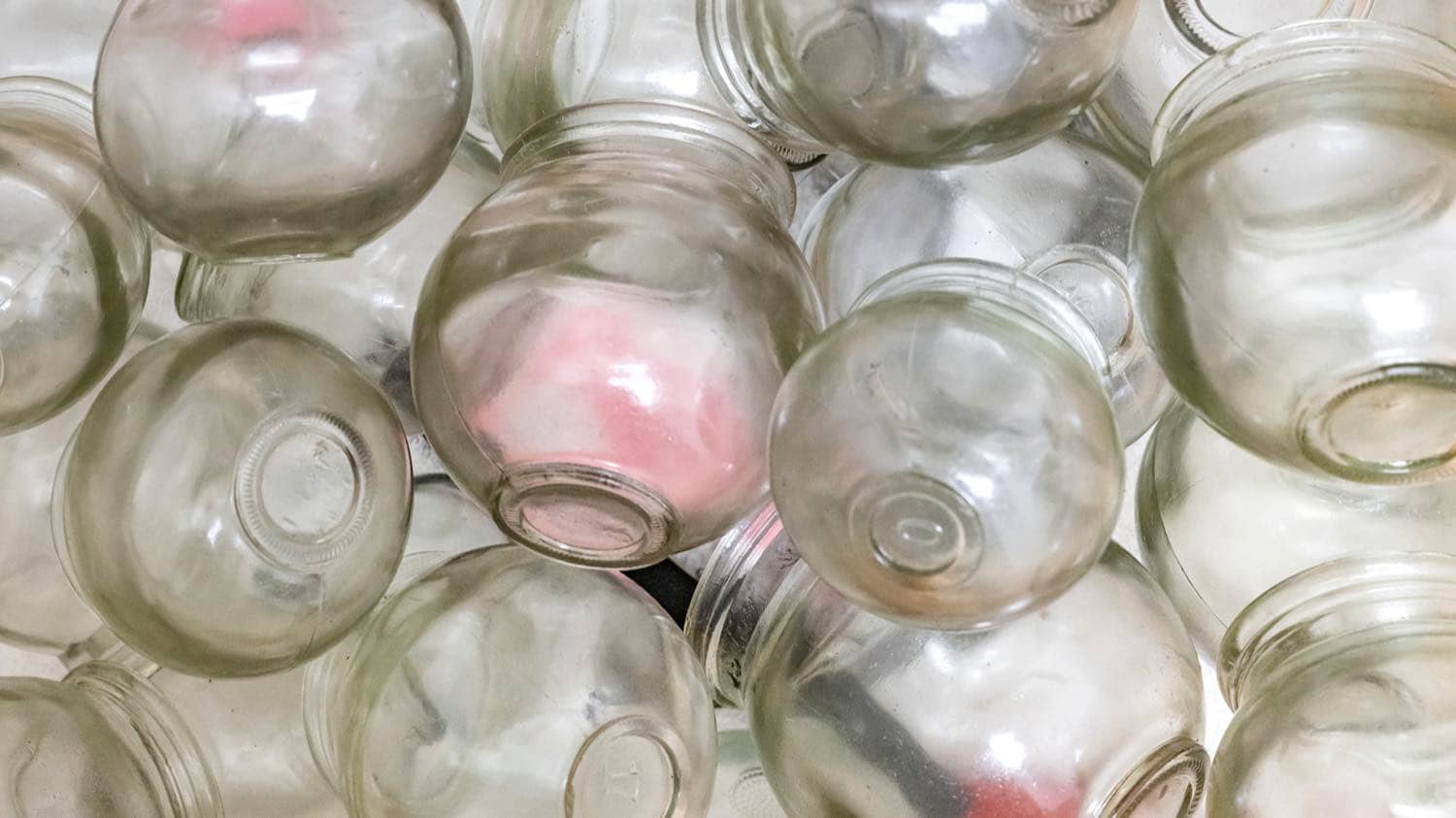 Glass cupping vessels used in treatment at iBODY